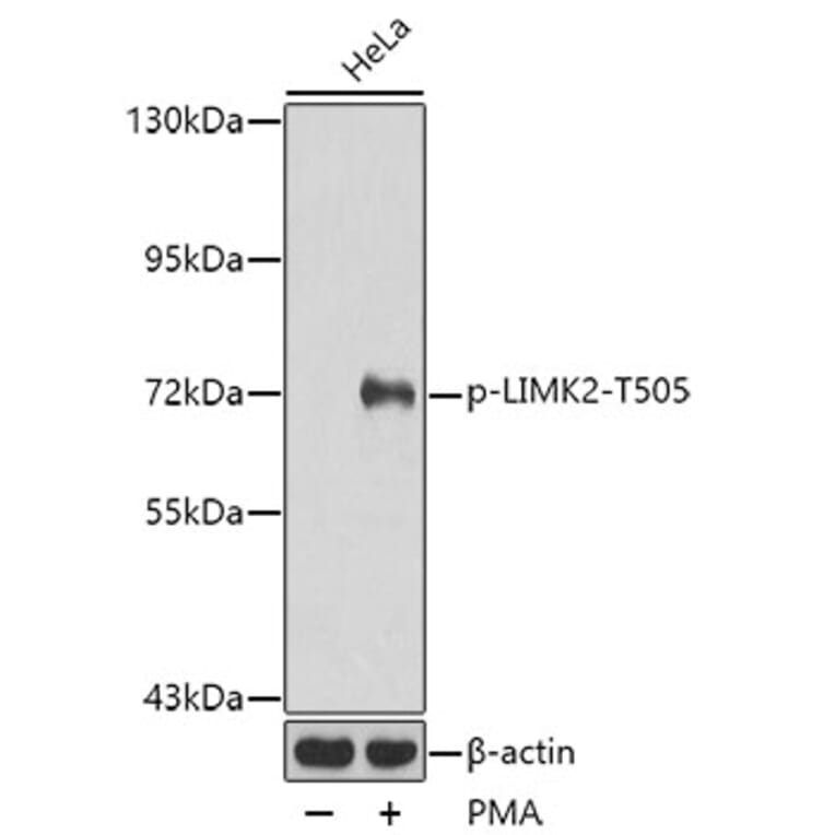 Western Blot - Anti-LIMK2 (phospho Thr505) Antibody (A16618) - Antibodies.com
