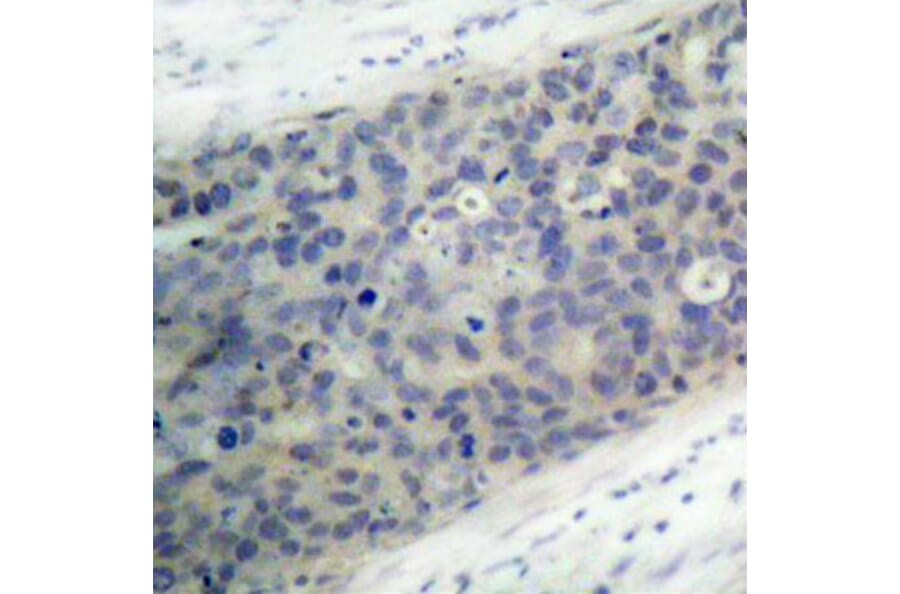 Immunohistochemistry - Anti-LIMK2 (phospho Thr505) Antibody (A16618) - Antibodies.com