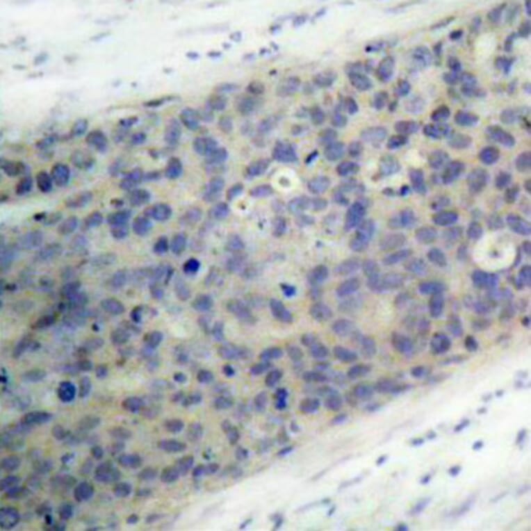 Immunohistochemistry - Anti-LIMK2 (phospho Thr505) Antibody (A16618) - Antibodies.com