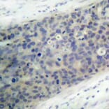 Immunohistochemistry - Anti-LIMK2 (phospho Thr505) Antibody (A16618) - Antibodies.com