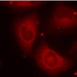 Immunofluorescence - Anti-LIMK2 (phospho Thr505) Antibody (A16618) - Antibodies.com