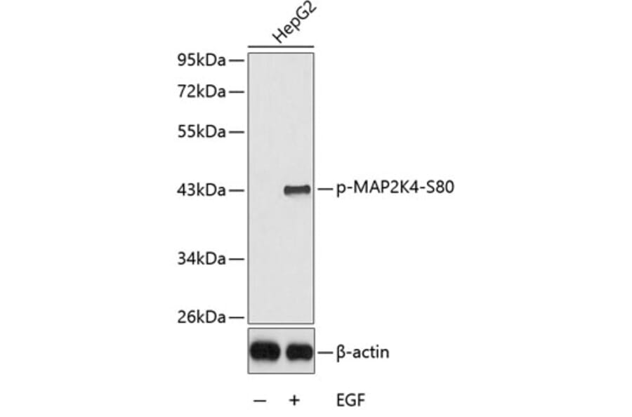 Western Blot - Anti-MAP2K4 (phospho S80) Antibody (AP0390) - Antibodies.com