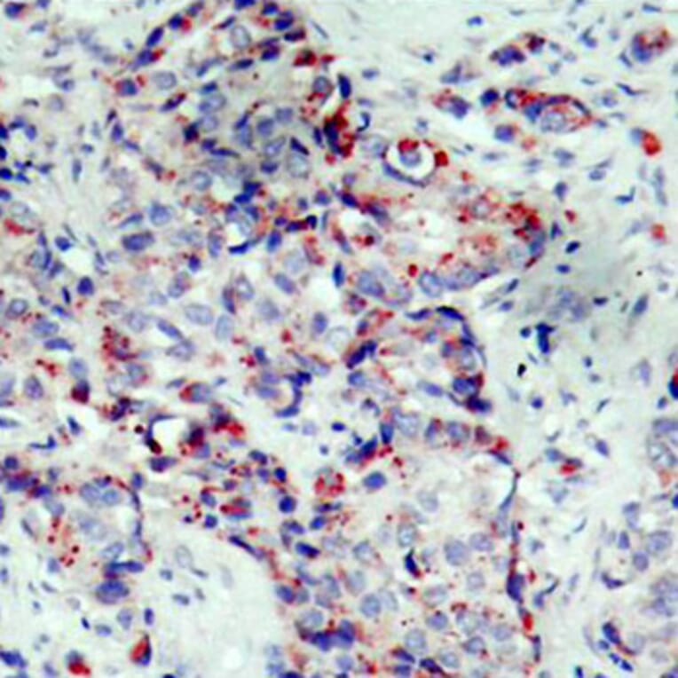 Immunohistochemistry - Anti-MAP2K4 (phospho S80) Antibody (AP0390) - Antibodies.com