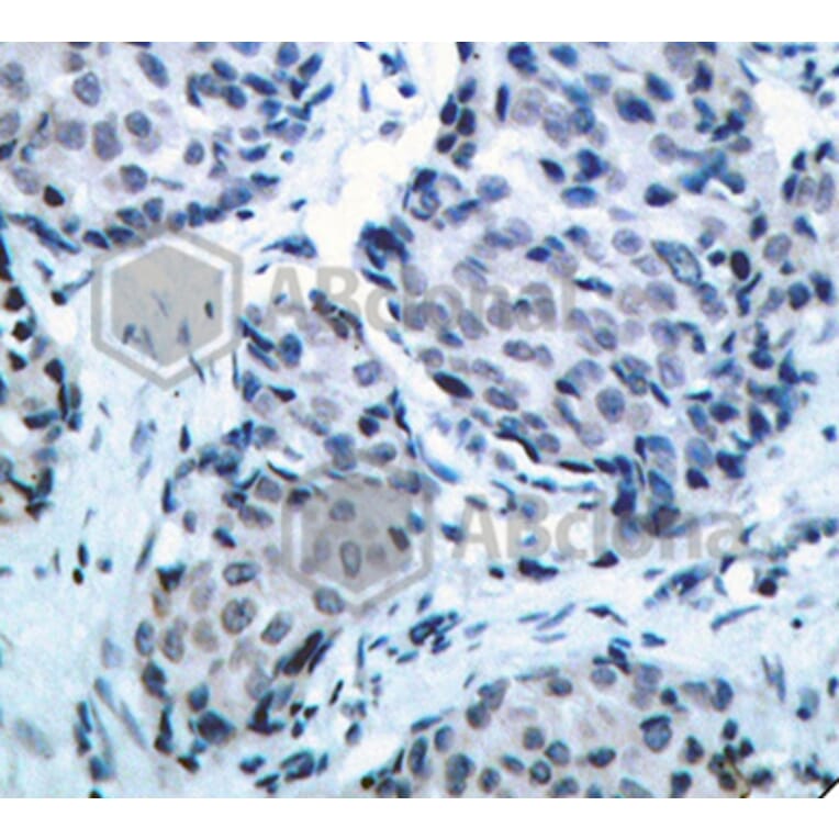 Immunohistochemistry - Anti-MAP2K4 (phospho T261) Antibody (AP0391) - Antibodies.com