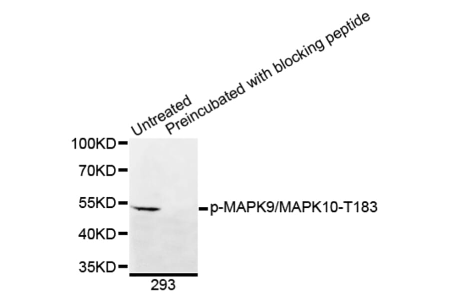 Western Blot - Anti-MAPK9 (phospho T183) + MAPK10 (phospho T183) Antibody (AP0395) - Antibodies.com