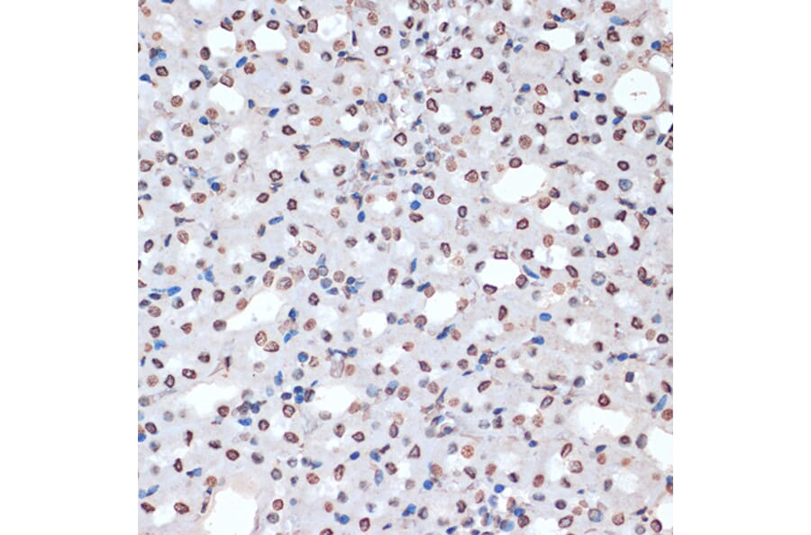 Immunohistochemistry - Anti-MK2 (phospho Thr334) Antibody (A16623) - Antibodies.com