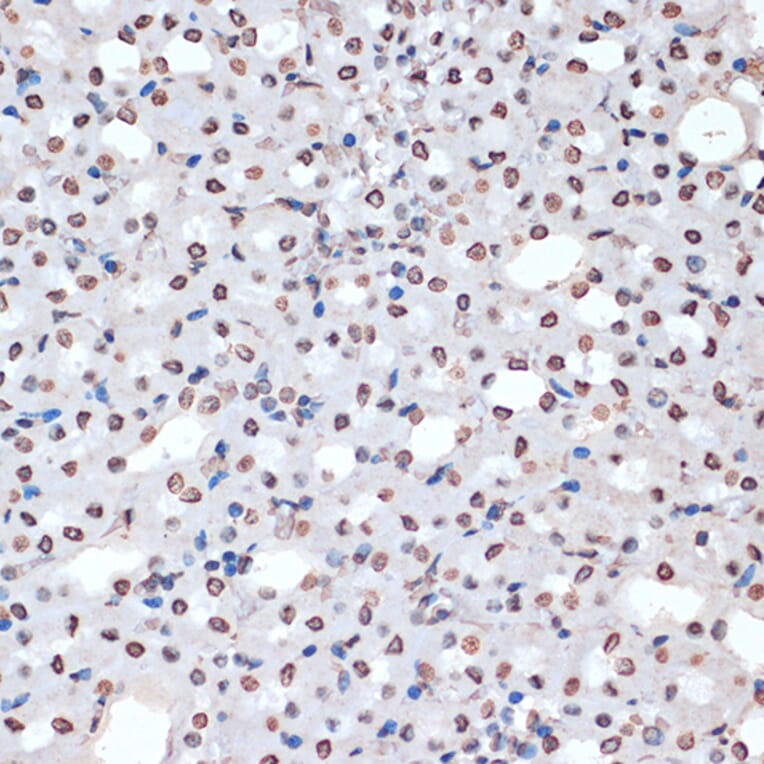 Immunohistochemistry - Anti-MK2 (phospho Thr334) Antibody (A16623) - Antibodies.com