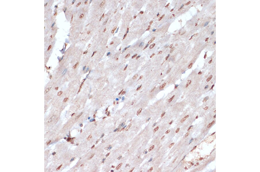 Immunohistochemistry - Anti-MK2 (phospho Thr334) Antibody (A16623) - Antibodies.com