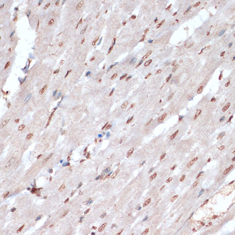 Immunohistochemistry - Anti-MK2 (phospho Thr334) Antibody (A16623) - Antibodies.com