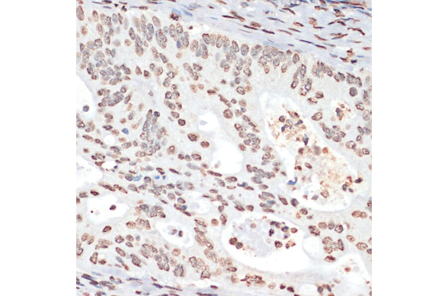 Immunohistochemistry - Anti-MK2 (phospho Thr334) Antibody (A16623) - Antibodies.com