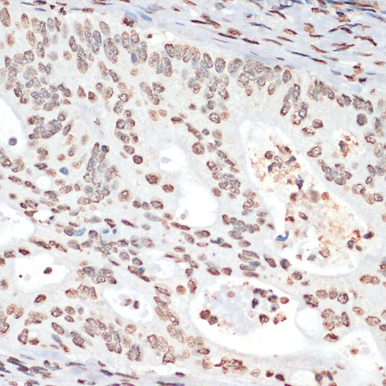 Immunohistochemistry - Anti-MK2 (phospho Thr334) Antibody (A16623) - Antibodies.com