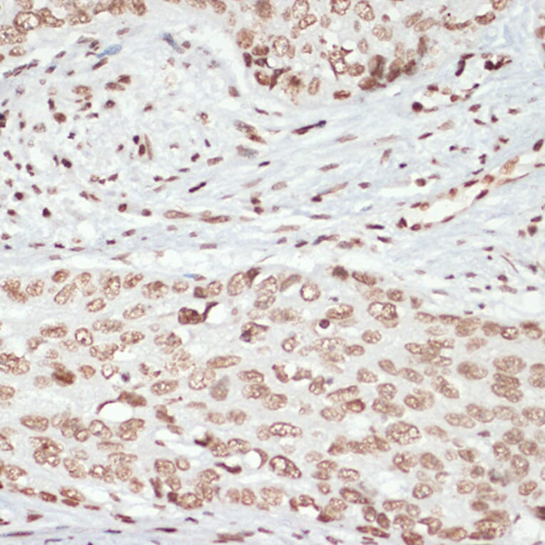 Immunohistochemistry - Anti-MK2 (phospho Thr334) Antibody (A16623) - Antibodies.com