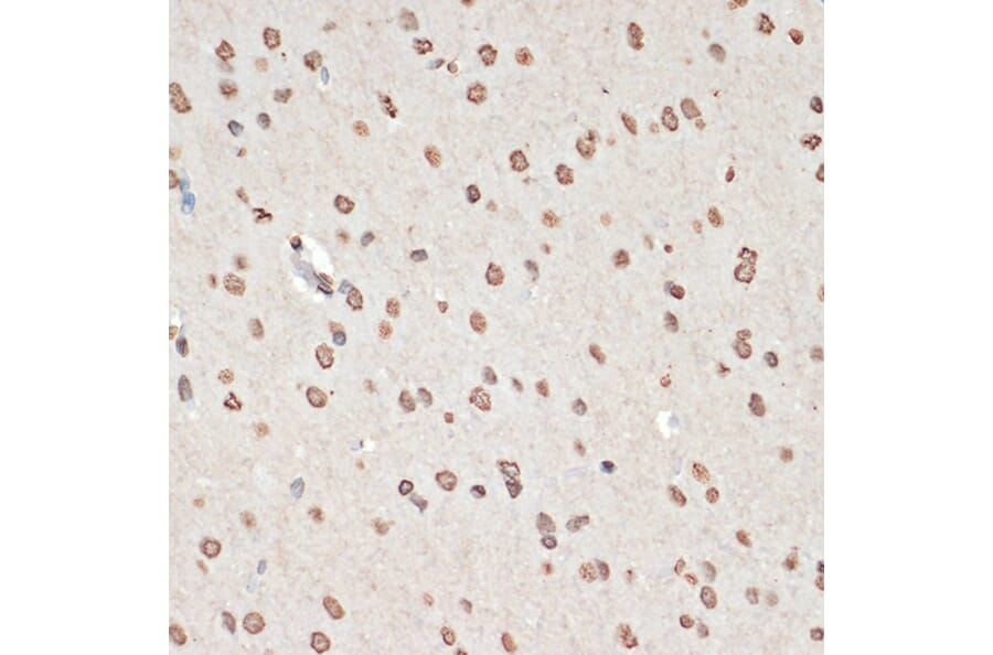 Immunohistochemistry - Anti-MK2 (phospho Thr334) Antibody (A16623) - Antibodies.com
