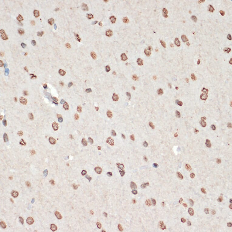 Immunohistochemistry - Anti-MK2 (phospho Thr334) Antibody (A16623) - Antibodies.com
