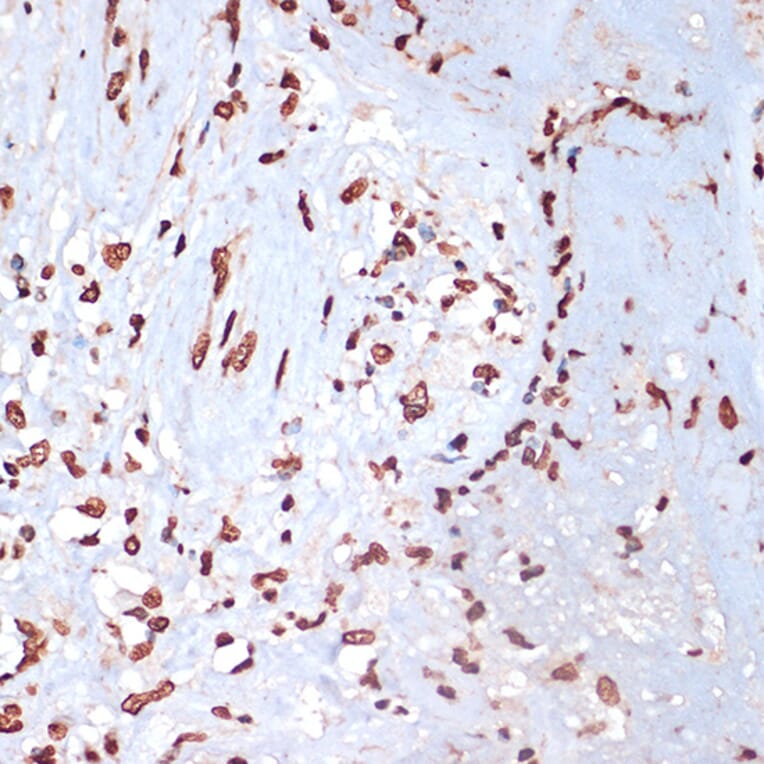 Immunohistochemistry - Anti-MK2 (phospho Thr334) Antibody (A16623) - Antibodies.com