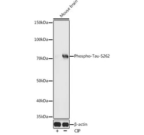 Western Blot - Anti-Tau (phospho Ser262) Antibody (A16624) - Antibodies.com