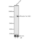 Western Blot - Anti-Tau (phospho Ser262) Antibody (A16624) - Antibodies.com