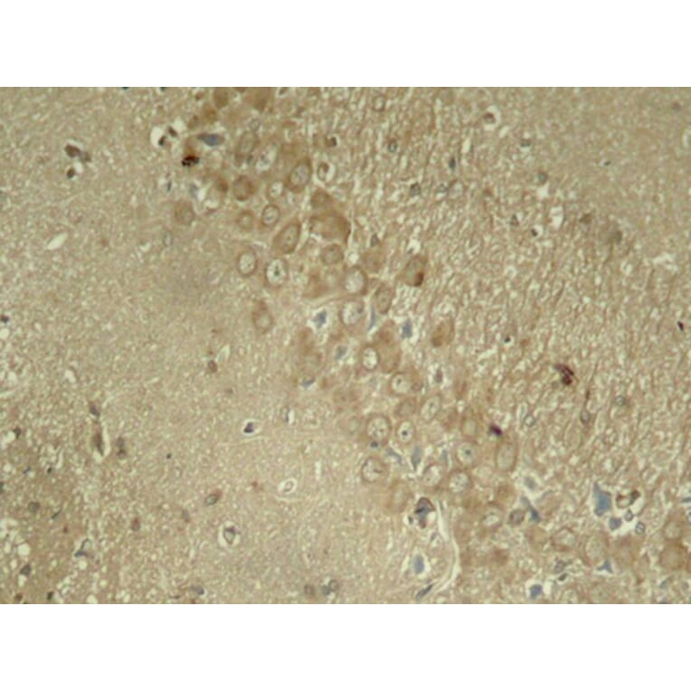 Immunohistochemistry - Anti-Tau (phospho Ser262) Antibody (A16624) - Antibodies.com