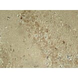 Immunohistochemistry - Anti-Tau (phospho Ser262) Antibody (A16624) - Antibodies.com