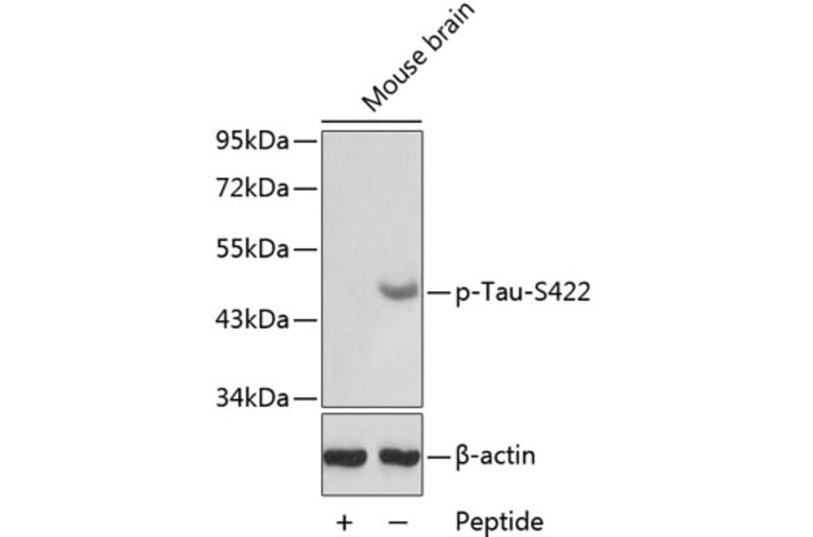 Western Blot - Anti-Tau (phospho S422) Antibody (AP0398) - Antibodies.com