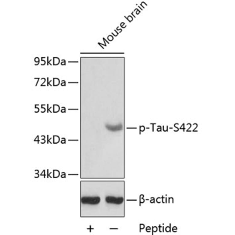 Western Blot - Anti-Tau (phospho S422) Antibody (AP0398) - Antibodies.com