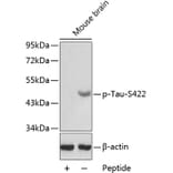 Western Blot - Anti-Tau (phospho S422) Antibody (AP0398) - Antibodies.com