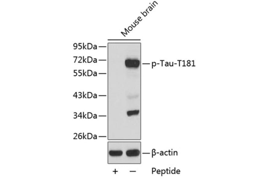 Western Blot - Anti-Tau (phospho T181) Antibody (AP0399) - Antibodies.com