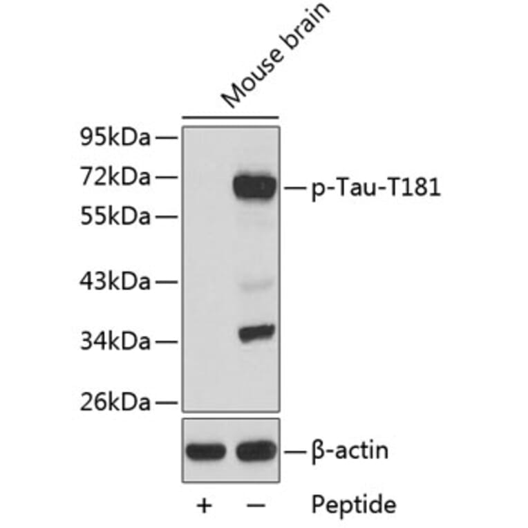 Western Blot - Anti-Tau (phospho T181) Antibody (AP0399) - Antibodies.com