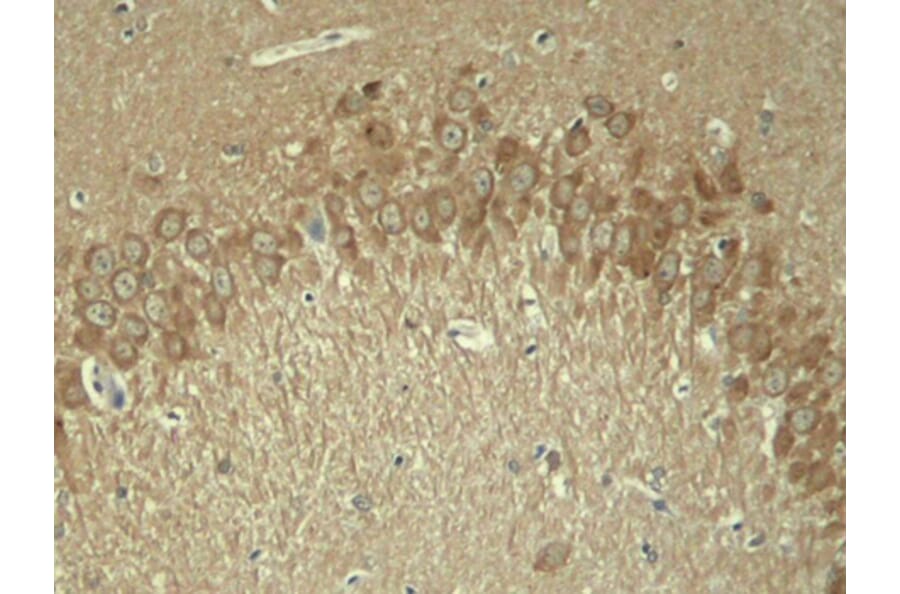 Immunohistochemistry - Anti-Tau (phospho T181) Antibody (AP0399) - Antibodies.com