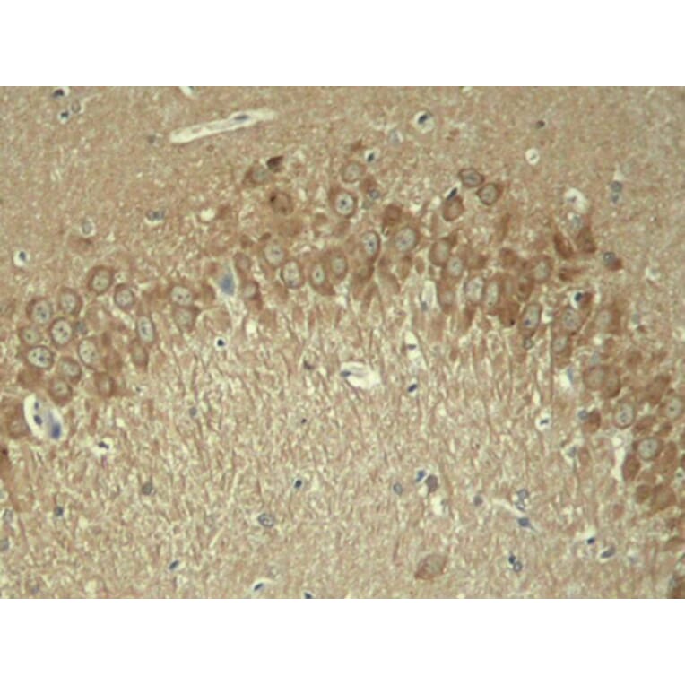 Immunohistochemistry - Anti-Tau (phospho T181) Antibody (AP0399) - Antibodies.com