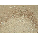 Immunohistochemistry - Anti-Tau (phospho T181) Antibody (AP0399) - Antibodies.com