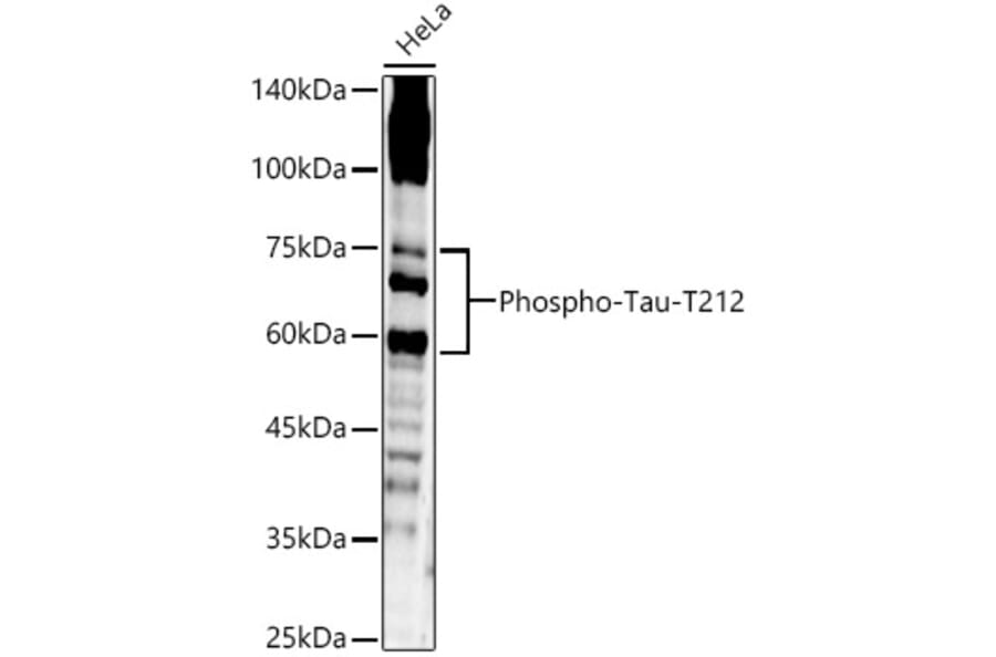 Western Blot - Anti-Tau (phospho Thr212) Antibody (A16627) - Antibodies.com