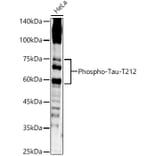 Western Blot - Anti-Tau (phospho Thr212) Antibody (A16627) - Antibodies.com