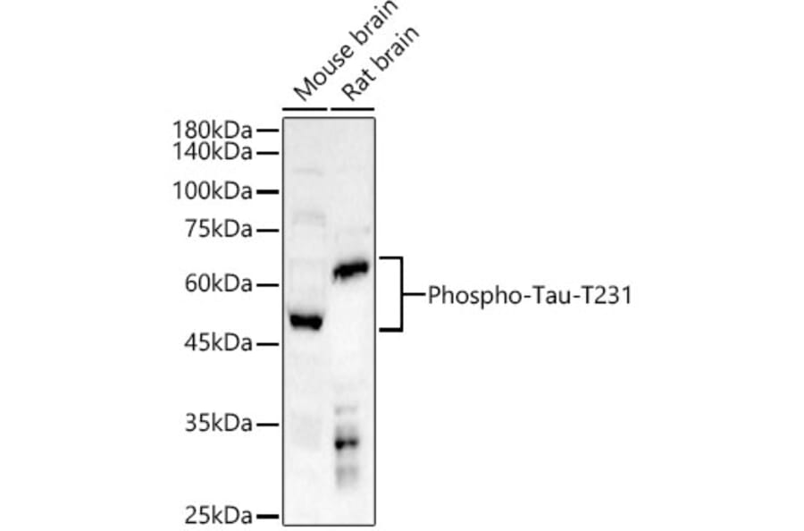 Western Blot - Anti-Tau (Phospho T231) Antibody (A16628) - Antibodies.com