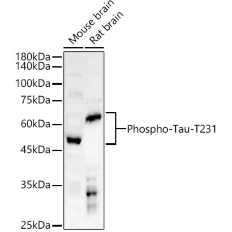 Western Blot - Anti-Tau (Phospho T231) Antibody (A16628) - Antibodies.com