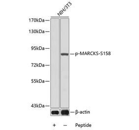 Western Blot - Anti-MARCKS (phospho Ser158) Antibody (A16629) - Antibodies.com