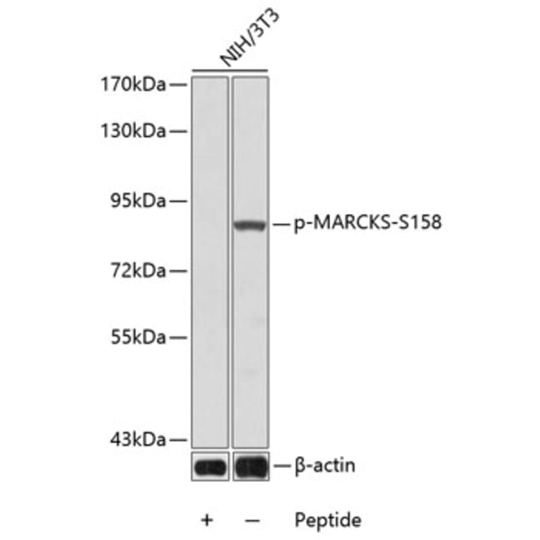 Western Blot - Anti-MARCKS (phospho Ser158) Antibody (A16629) - Antibodies.com