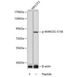 Western Blot - Anti-MARCKS (phospho Ser158) Antibody (A16629) - Antibodies.com
