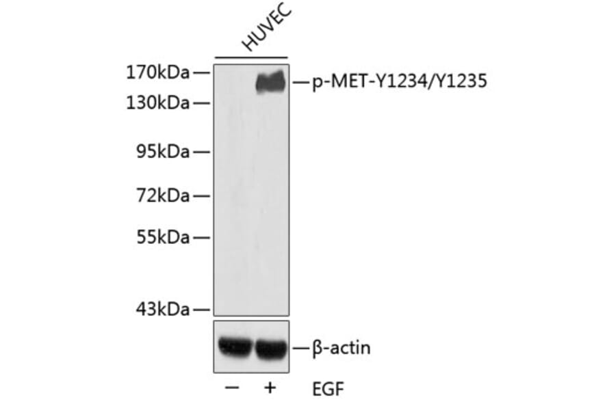 Western Blot - Anti-MET (phospho Y1234 + Y1235) Antibody (AP0408) - Antibodies.com