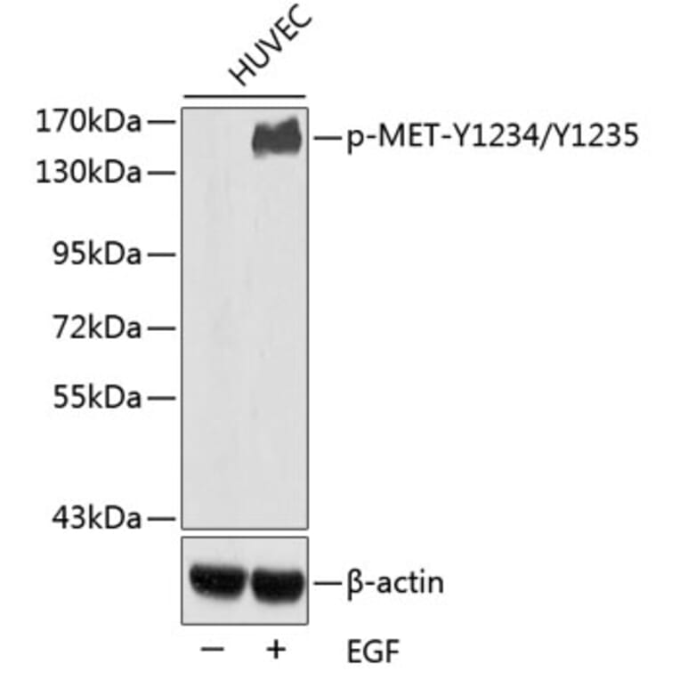 Western Blot - Anti-MET (phospho Y1234 + Y1235) Antibody (AP0408) - Antibodies.com