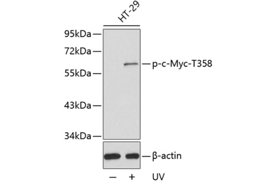 Western Blot - Anti-c-Myc (phospho Thr358) Antibody (A16636) - Antibodies.com