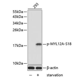 Western Blot - Anti-MYL12A (phospho Ser18) Antibody (A16637) - Antibodies.com