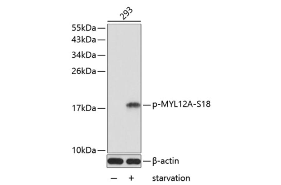 Western Blot - Anti-MYL12A (phospho Ser18) Antibody (A16637) - Antibodies.com