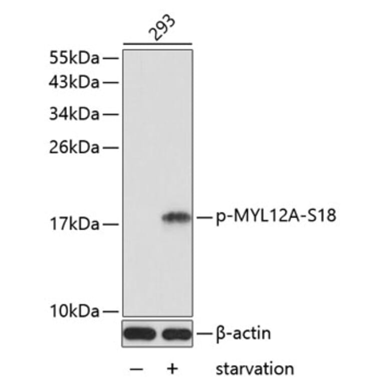 Western Blot - Anti-MYL12A (phospho Ser18) Antibody (A16637) - Antibodies.com