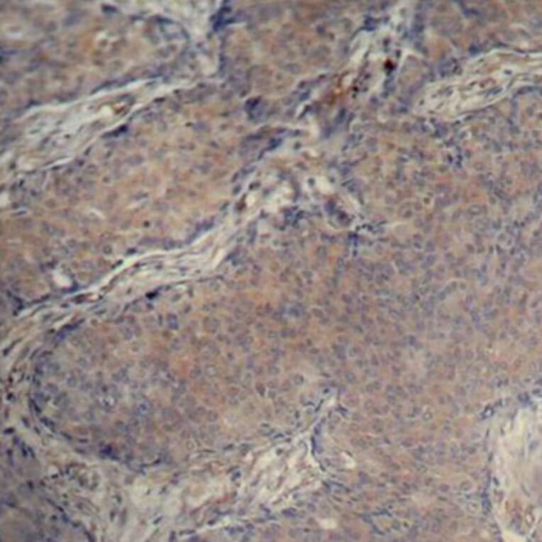 Immunohistochemistry - Anti-MYL12A (phospho Ser18) Antibody (A16637) - Antibodies.com