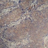 Immunohistochemistry - Anti-MYL12A (phospho Ser18) Antibody (A16637) - Antibodies.com