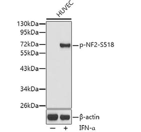 Western Blot - Anti-NF2 / Merlin (phospho Ser518) Antibody (A16638) - Antibodies.com