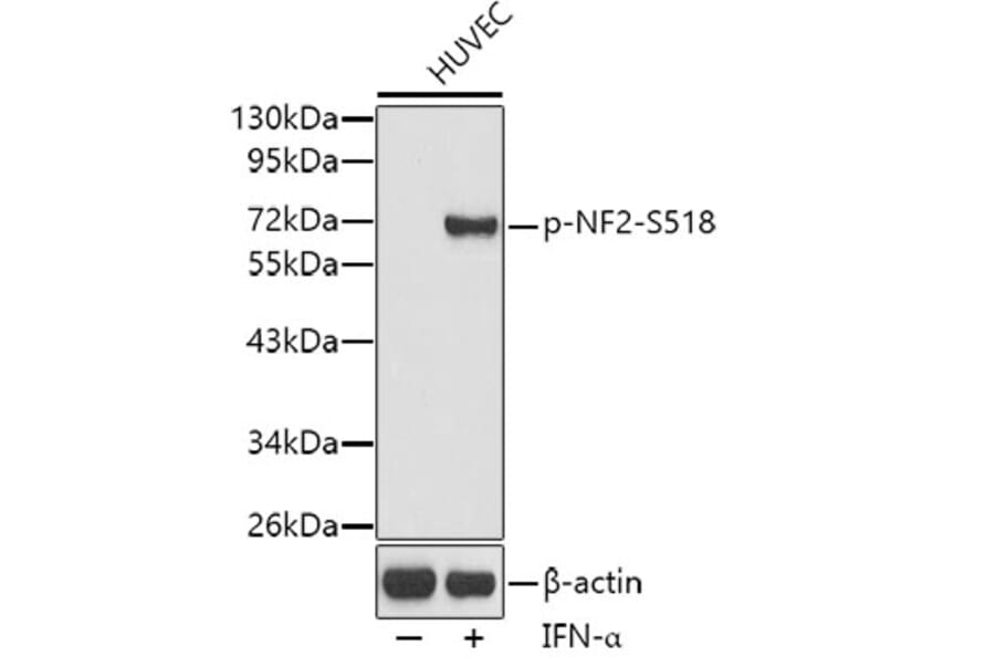 Western Blot - Anti-NF2/Merlin (phospho Ser518) Antibody (A16638) - Antibodies.com
