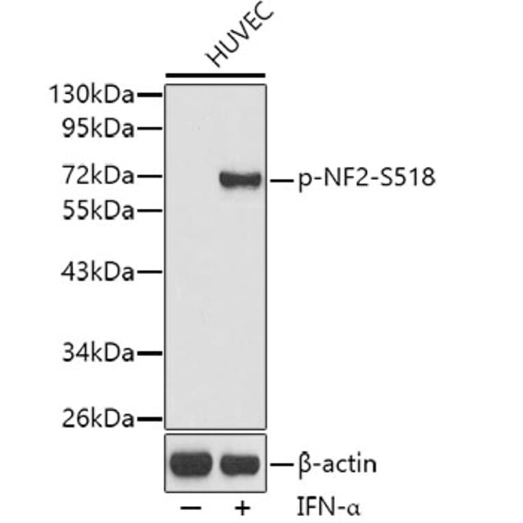 Western Blot - Anti-NF2/Merlin (phospho Ser518) Antibody (A16638) - Antibodies.com