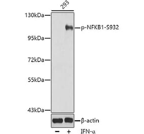 Western Blot - Anti-NFkB p105 / p50 (phospho Ser932) Antibody (A16639) - Antibodies.com